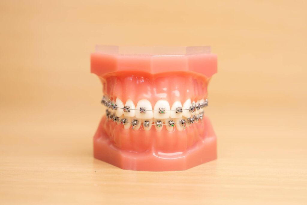 paso robles orthodontics