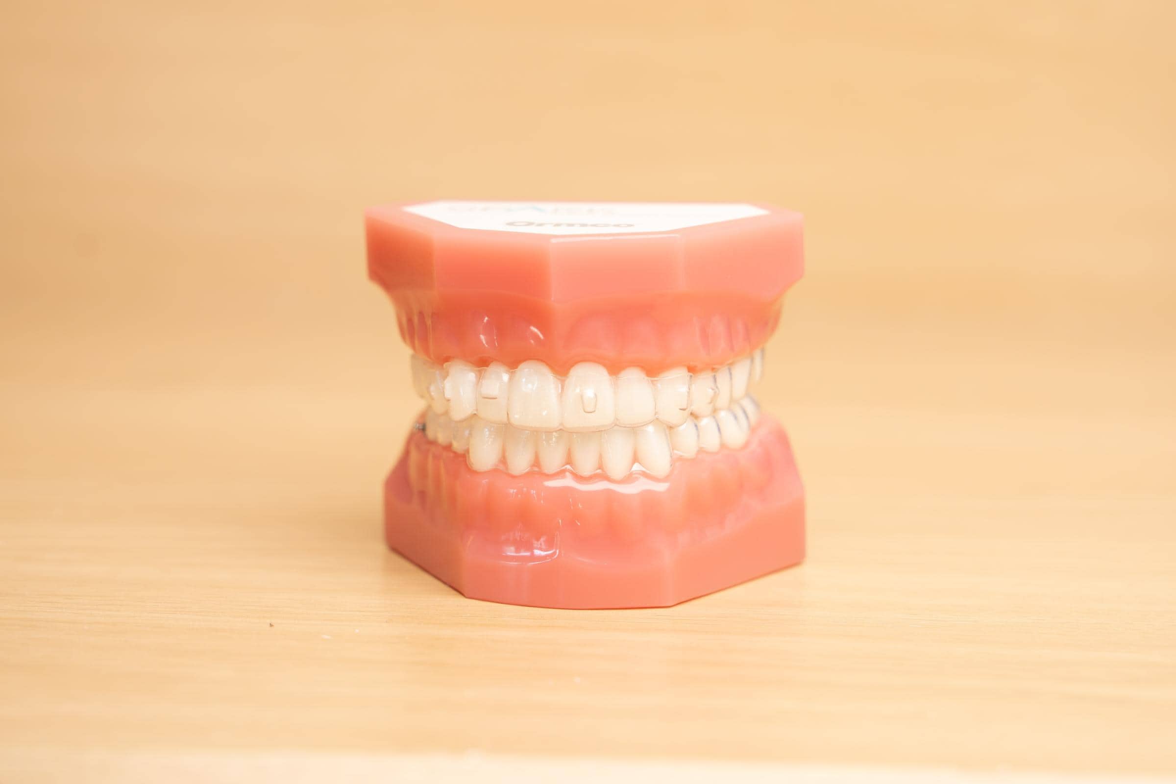 Clear Aligners