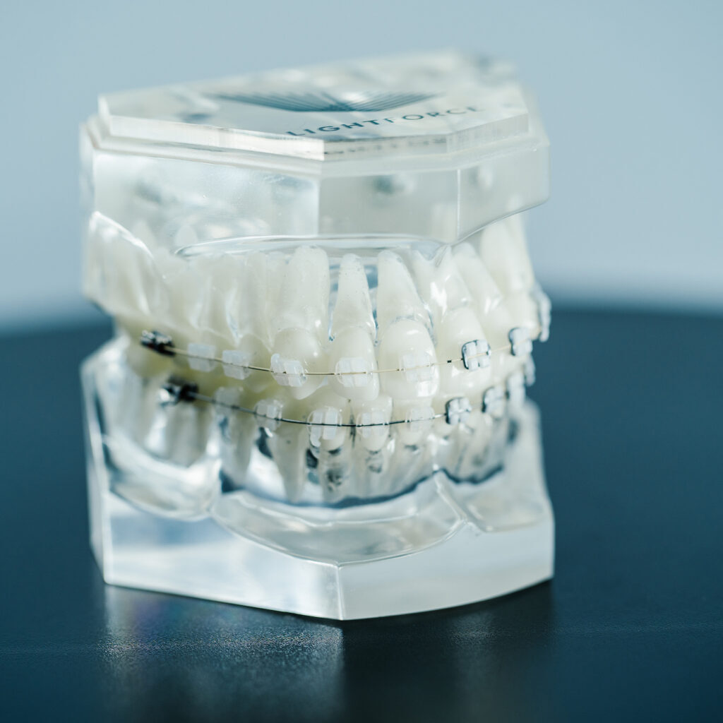 orthodontist atascadero